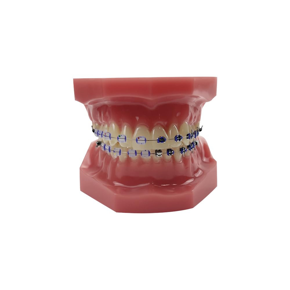 Orthodontisches Zahnmodell mit Halterungen, YOUYA DENTAL Demonstration Orthodontisches Modell für Bildung, Zähne Demonstration Typodonte Anatomisches Lehrwerkzeug mit Metall und Keramischer Halterung