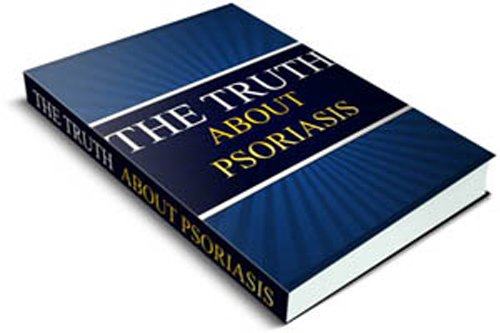 The Truth About Psoriasis