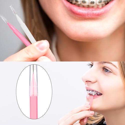 Image of Patelai 100 Pieces Braces Dental Brush for Cleaner Interdental Toothpick Dental Tooth Flossing Head Oral Hygiene Flosser Toothpick Cleaners Tooth Tool(White, Light Pink,Multiple Sizes)