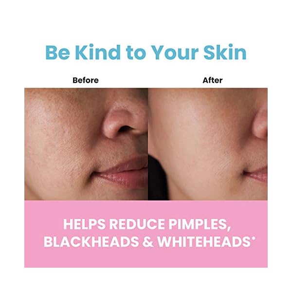 One Living Earth Collagen Facial Mask for Women - Collagen, Triple Action Clay & Charcoal - 6oz