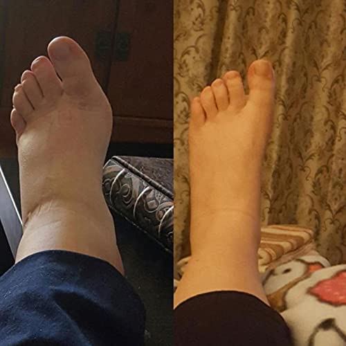 Meia de Compressão Varicosa Meias Unissex Pressão Veias Varizes Meia Joelho Alto Suporte Esticamento