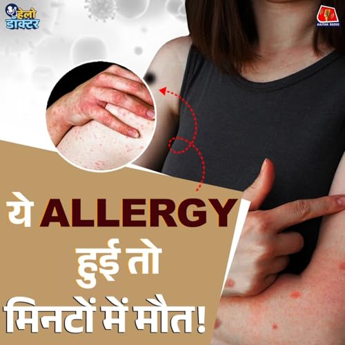 मिनटों में जान ले लेने वाली एलर्जी! लक्षण पहचानें और जान बचाएं : हेलो डॉक्टर