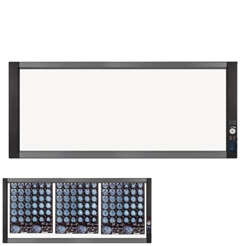 Professionelle Röntgenfilm-leuchtbox, Röntgenfilmbetrachter mit Halterung, Helligkeit 0–100% Einstellbar, für Kliniken und Krankenhäuser(47x19.5in/120x50cm)