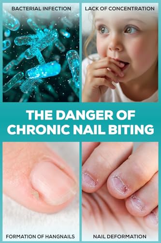 NIXXIT Nail Biting Prevention for Kids - Thumb Sucking Deterrent for Kids, Toddlers, Children - No Bite Nail Polish Pen - Bitter Taste - Safe & Effective Solution for Age 3+
