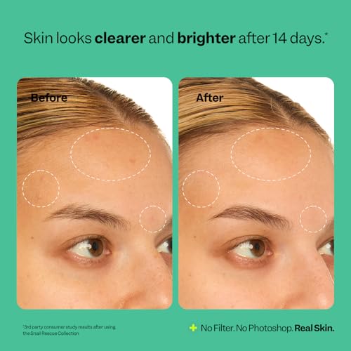 Peach Slices Snail Rescue Intensive Serum (95% Snail Mucin) — view 6