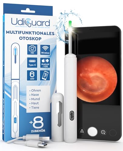 Ohrenschmalz Entferner Otoskop mit Kamera 1920p 3,6mm WiFi Ohrenreiniger - UdiGuard Ohrenspiegel Ohr mit 6 LED-Leuchten Erwachsene Kaninchen und Kinder Weiße - Kompatibel mit iPhone iPad Android
