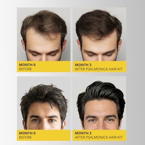 Image of Hair Growth Shampoo and Conditioner Set: Sulfate Free Hair Growth Root Activator Thickening Shampoo for Hair Loss and Thinning Hair - Hair Loss RegrowthTreatments for Women Men