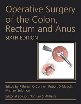 OPERATIVE SURGERY OF THE COLON RECTUM AND ANUS 6ED (HB 2015)