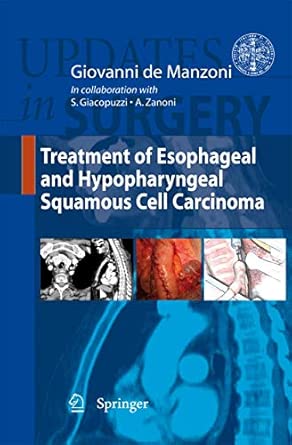 Treatment of Esophageal and Hypopharyngeal Squamous Cell Carcinoma: 13 2012th Edition Treatment of Esophageal and Hypopharyngeal Squamous Cell Carcinoma: 13 2012th Edition book cover