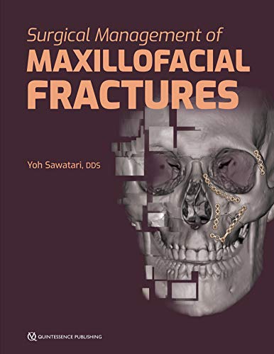 Surgical Management of Maxillofacial Fractures (English Edition)
