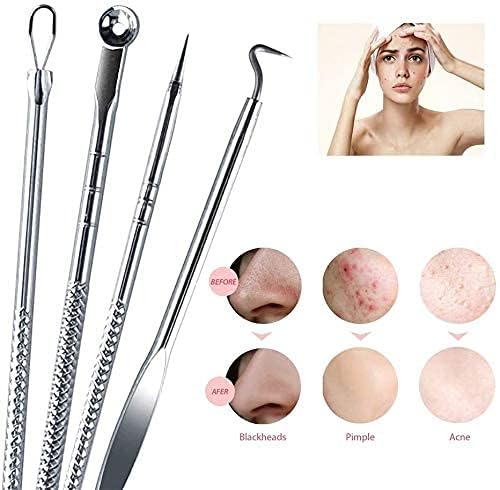 Image of 4Pcs Blackhead Pimple Remover Tools for Professional Tweezers Kit for Remove Acne Comedone Extractor, Black Heads Removing on Face Removal