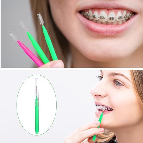 Image of Patelai 100 Pieces Braces Dental Brush for Cleaner Interdental Toothpick Dental Tooth Flossing Head Oral Hygiene Flosser Toothpick Cleaners Tooth Tool(Green,Pink,Mixed Size)