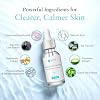 Salicylic 10% Gel Peel, Breakout and Pore Minimizer and Cleanser, 15-30 Full Facial Chemical Peels, 1 fl oz. e, 30 mL Perfect Image