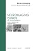 Stroke Imaging, An Issue of Neuroimaging Clinics (Volume 21-2) (The Clinics: Radiology, Volume 21-2)