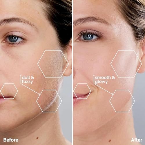 Image of Facial Hair Removal for Women: Electric Face Razor with LED Light - Painless & Instant Results Mini Shaver for Travel & Home Use