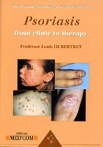 PSORIASIS VERSION ANGLAISE (0000)