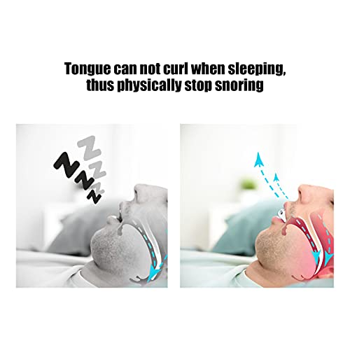 Paradenti Anti-russamento, Dispositivo