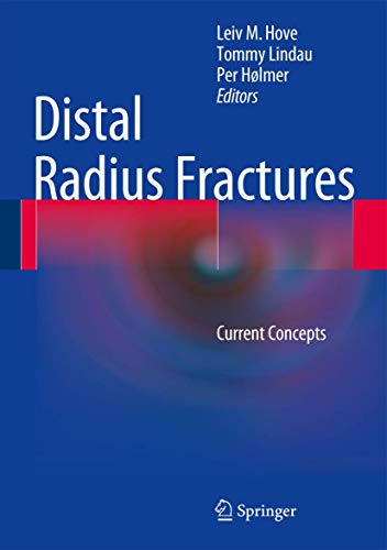 Preisvergleich Produktbild Distal Radius Fractures: Current Concepts
