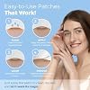 MEDca Acne Patches for Face - Hydrocolloid Bandages (36 Count) Pimple Patches for Face in 2 Universal Sizes, Acne Spot Treatment Care for Face & Skin Spot Patch Conceals Zits, Acne and Blackheads