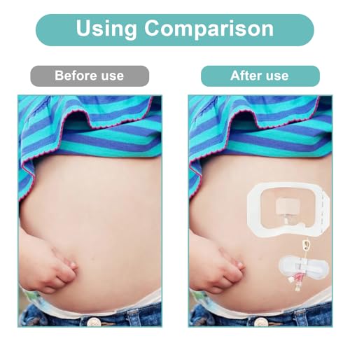 Catheter Stabilization Device,Feeding Tube Holder,Self Adhesive Catheter Holder Patch Dressing (10 Pack) - Thumbnail 7
