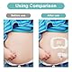 20Pcs Katheter Stabilisierungsgerät für Kinder,Urinary Bein Bag Bein Strap Halter Aufkleber,Statlock Foley Katheter Halter Adhesive Katheter Supplies für G Tube und Feeding Tube