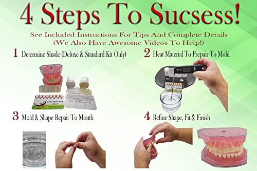 Smilefix Color Matching Deluxe Dental Repair Kit - Replace Missing Or Broken Tooth. Gaps, Broken Teeth Space Temporary Quick & Safe. Regain Your Confidence And Beautiful Smile In Minutes At Home! #TOP3