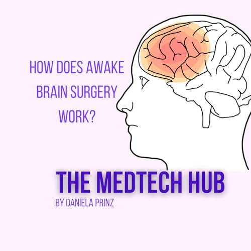 #15 How does awake brain surgery work?
