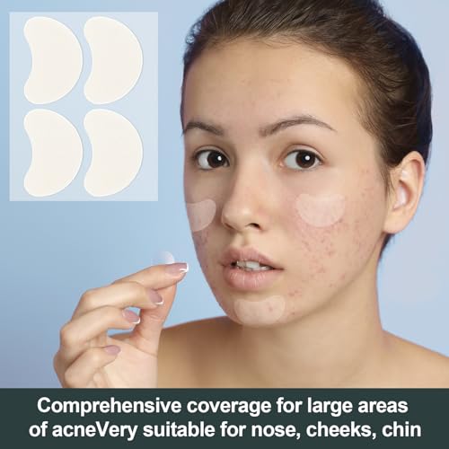 SmallCat 7 folhas de adesivos grandes de espinhas com ácido salicílico, adesivo hidrocolóide de espi