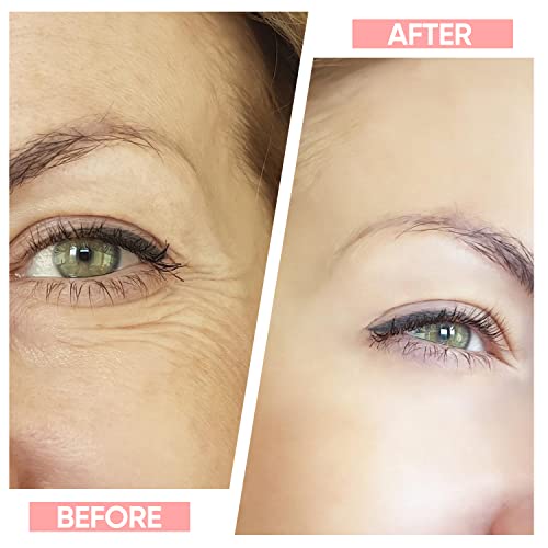 Hepsun Firming Wrinkle Removal 7 Color Mode Skin Rejuvenation For Face Neck Beauty Device, Handset Neck Tightening Face Shaper For Jawline Anti-Aging Device #TOP4