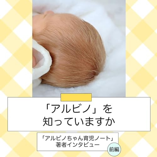 『「アルビノ」を知っていますか~「アルビノちゃん育児ノート」著者インタビュー(前編)』のカバーアート