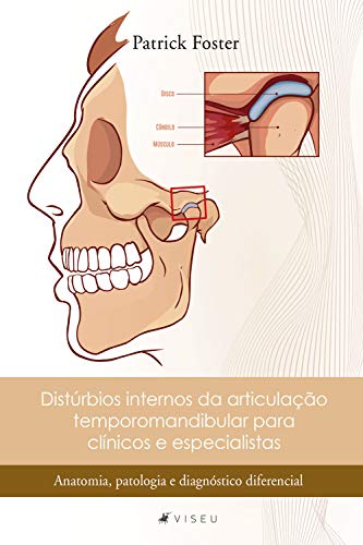 Distúrbios internos da articulação temporomandibular para clínicos e especialistas: Anatomia, patologia e diagnóstico diferencial - Foster, Patrick