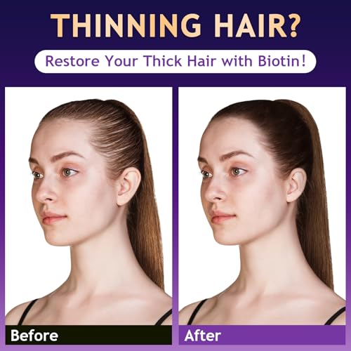 Image of Biotin Hair Growth & Thickening Shampoo with Root Activator, Hair Loss Shampoo for Men And Women, Strengthen Roots, Control Oil & Thicken Thin Hair, Sulfate-Free, for All Hair Types, 10.1 Fl Oz-Fresh