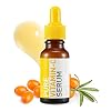 SKINMISO Vitamin C Serum - Brightens, Hydrates & Lightens Dark Spots, For All Skin Types, 0.7 oz