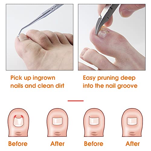 Image of MAYCREATE Ingrown Toenail Clippers for Ingrown or Thick Toenails,Wide Jaw Opening Nail Clippers with Curved and Slant Straight Blade Edge, 6 PCS Stainless Steel Toe Nail Clipper for Men