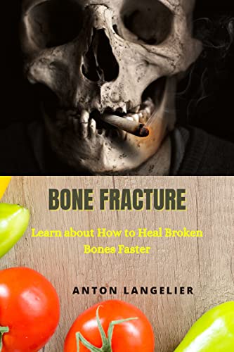 Bone Fracture: Learn about How to Heal Broken Bones Faster