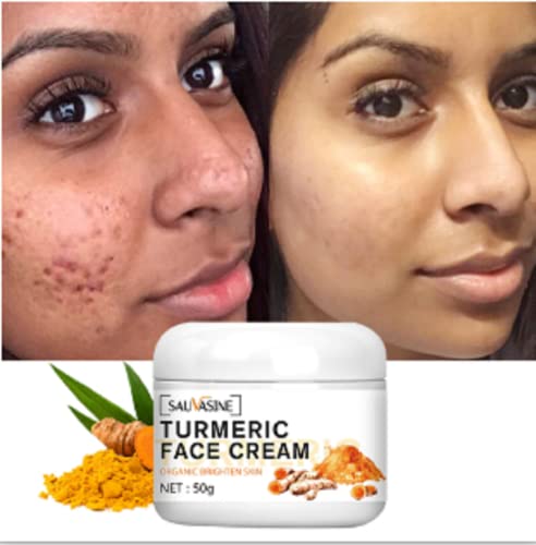 Lanthome Turmeric Face Cream For Face (50G)-Skin Care Anti-Aging Cream Face Moisturizer Cream,Skin Moisturizing Repair Cream, Turmeric Moisturizer Cream For Dark Spots #TOP5