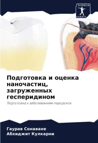 Подготовка и оценка наночастиц, загруженных гесперидином: Подготовка к заболеваниям пародонта (Russian Edition)
