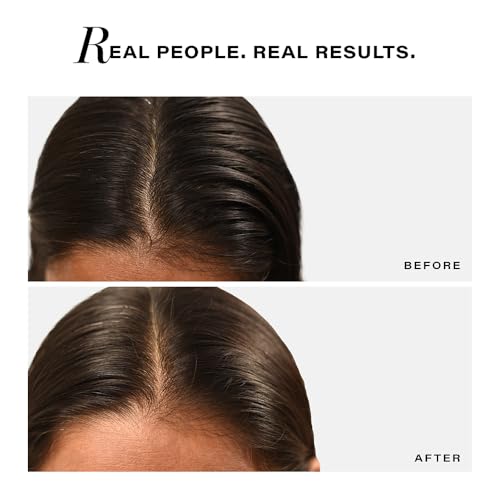 Image of Novology Sebosys Control Scalp Serum for 48hrs Oil Control with 1% Capryloyl, Salicylic Acid, Niacinamide| Targets greasy hair and itchy scalp | 50ml