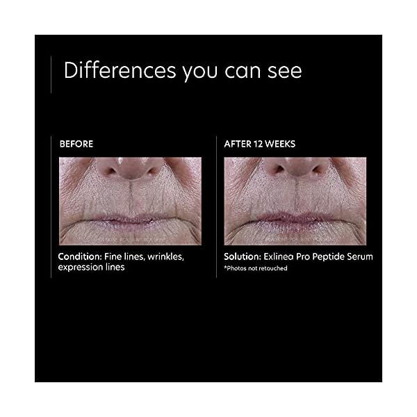 PCA SKIN ExLinea Pro Peptide Serum for Face, Peptide Complex Serum, Helps Lift, Tighten, and Firm Skin and Reduces Wrinkle Depths, Hydrating Anti Aging Serum for Women, 1.0 oz Pump