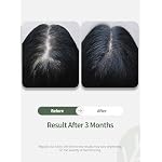 Hair Growth Serum, Women's Anti-Hair Loss Scalp Treatment, Helps with Severe Signs of Thinning, Non-Greasy, No-Rinse, Cruelty-Free, Vegan. - Image 3