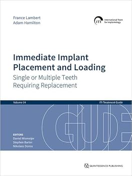 Immediate Implant Placement and Loading: Single or Multiple Teeth Requiring Replacement (ITI Treatment Guides, 14)