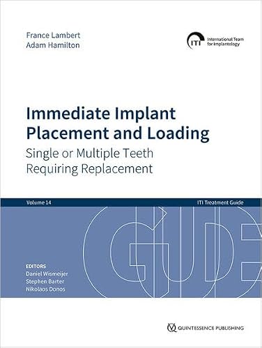 Immediate Implant Placement and Loading: Single... 1786981270 Book Cover