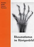  Rheumatismus im Röntgenbild