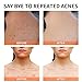 YAFUSIPE Acne Treatment for Face for Hormonal Cystic Stubborn Acne Cream for Sensitive Skin Teens Adults Women Men Spot Pimple Butt Control Rapid Clearing Breakout Overnight Face Blemish Treatment