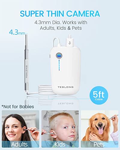 Teslong Digital Otoscope With Ear Wax Remover, Teslong Ear Camera With Ear Wax Removal Tools, Video Ear Scope Otoscope With Light For Iphone, Ipad, Android Phone, Usb, Ear Picks, 1080P Hd #TOP4