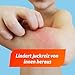 Fenistil Tropfen, Dimetindenmaleat 1mg/ ml Lösung zum Einnehmen, hilft bei allergischem Schnupfen und windpockenassoziiertem Juckreiz, 3x 20 ml