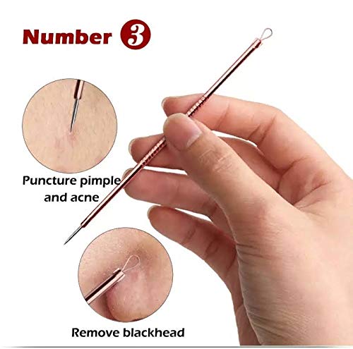 Kit 4 Peças Pinça Extrator Removedor De Cravo Espinha Acne Rose