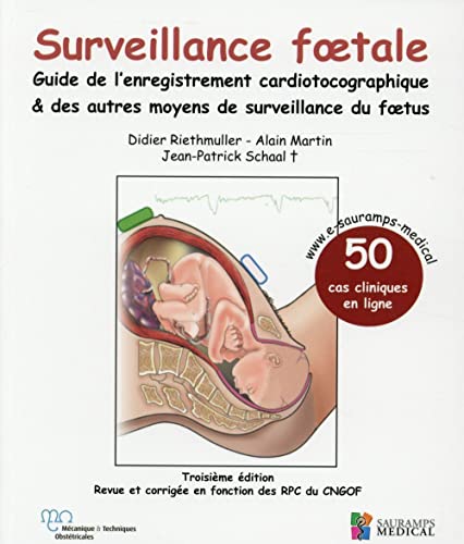 SAURAMPS MEDICA - SURVEILLANCE FOETALE - GUIDE DE L'ENREGISTREMENT CARDIOTOCOGRAPHIQUE & AUTRES MO