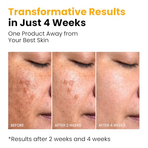 QUIA Turmeric + Kojic Acid Overnight Wrapping Mask – Hydration Mask for Glowing Skin – Evens Tone, Soothes Redness and Improves Skin Texture – Korean Skincare 75ML - Image 6