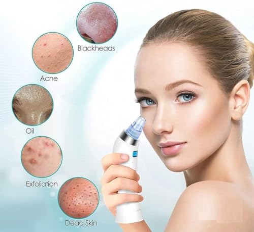 Image of 4 In 1 Multi-Function Blackhead Whitehead Extractor Remover Device Facial Cleansing Tool,Skin Cleaner,Pimple Removal Tool,Acne Pimple Pore Cleaner Vacuum Suction Tool For Men & Women (white1)